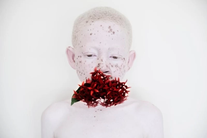 Смертельная белизна: невероятные портреты альбиносов Танзании