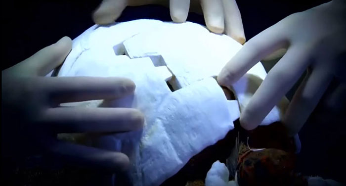 Умирающая черепаха была спасена благодаря 3D-панцирю напечатанному на принтере
